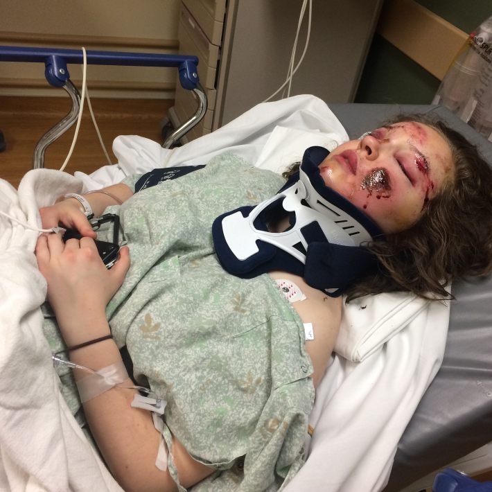 Annie Zidek in the hospital after the crash. Photo courtesy of the Zidek family